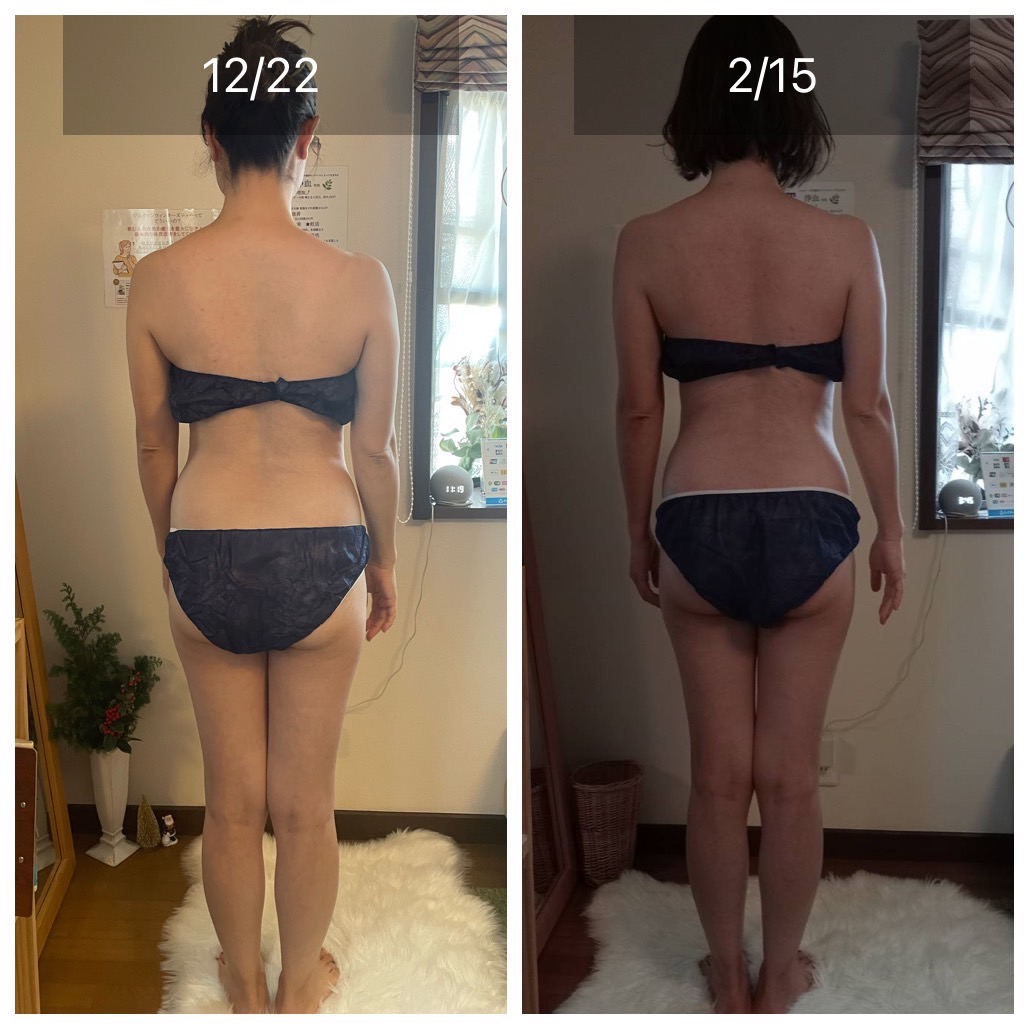 ビフォーアフター