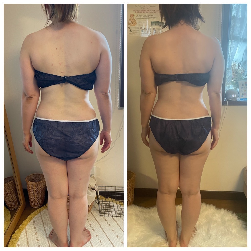 ビフォーアフター